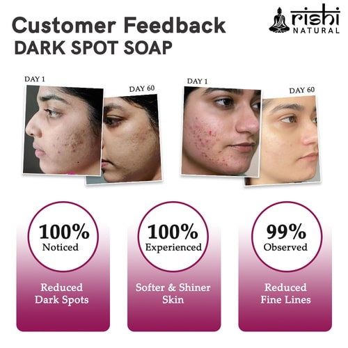 visible results of Rishi natural Dark Spot removal soap